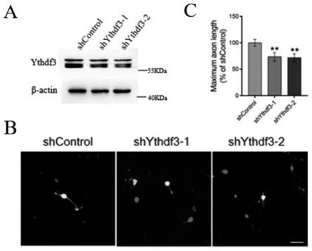 RNA结合蛋白Ythdf3的应用、治疗神经轴突损伤的靶点及药物的制作方法
