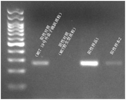 cDNA、mRNA、蛋白及评价胶质瘤预后性的试剂盒和系统的制作方法