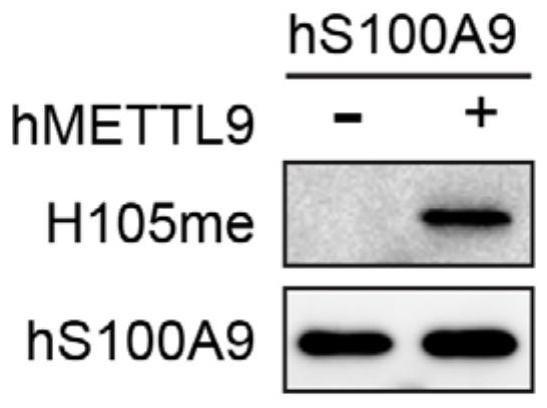 特定组氨酸甲基化修饰的S100A9蛋白免疫原、多克隆抗体及其制备方法与流程