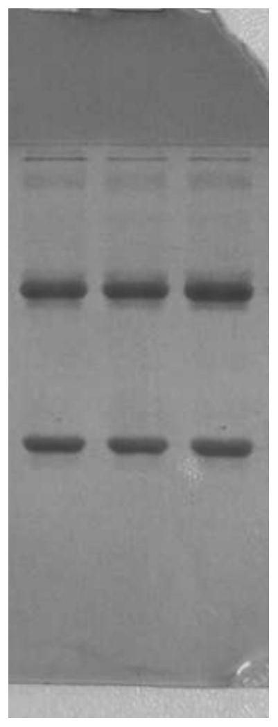 抗NGAL的单克隆抗体及其应用和检测试剂盒的制作方法