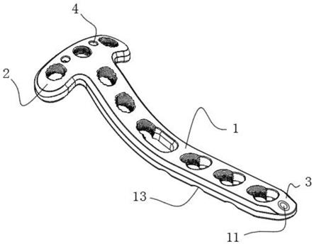 带线修复万向锁定系统胫骨近端后侧锁定金属接骨板的制作方法