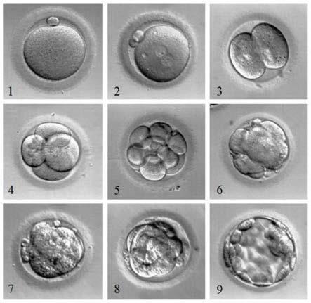 一种人类卵母细胞体外受精前培养方法和系列培养液与应用与流程
