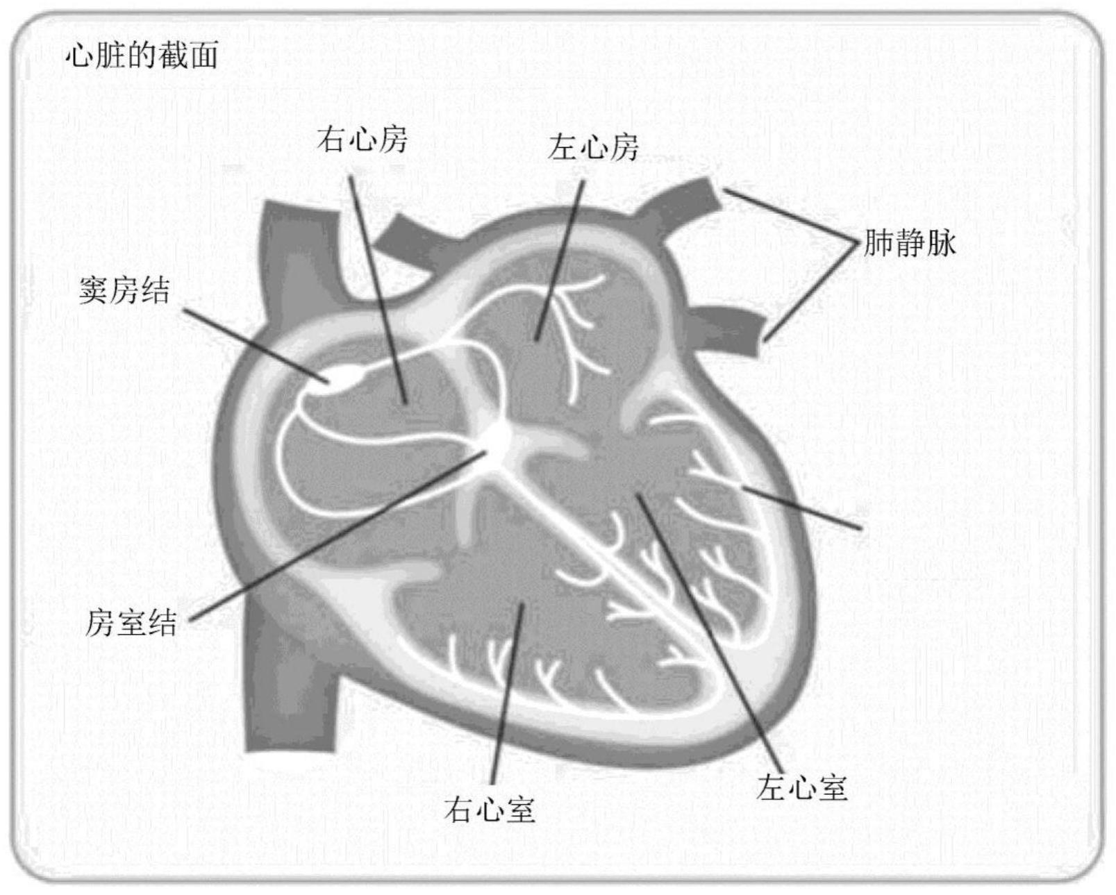 心房颤动治疗用导管及利用其的心房颤动治疗方法与流程
