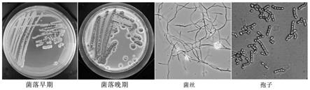 一株水稻内生灰褐色链霉菌Ahn75及其应用的制作方法