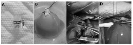 一种改良的静脉内衬支架大鼠原位肝移植模型建立方法与流程