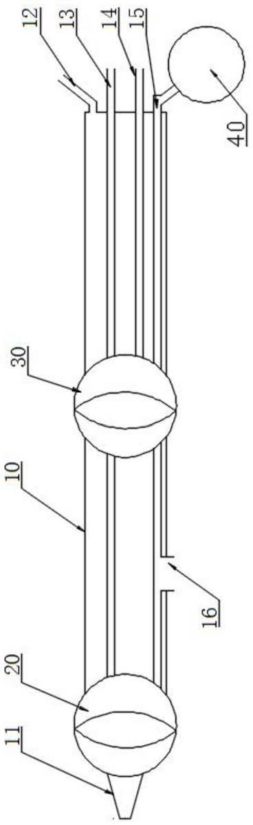 单球囊输尿管液气扩张管道套件的制作方法