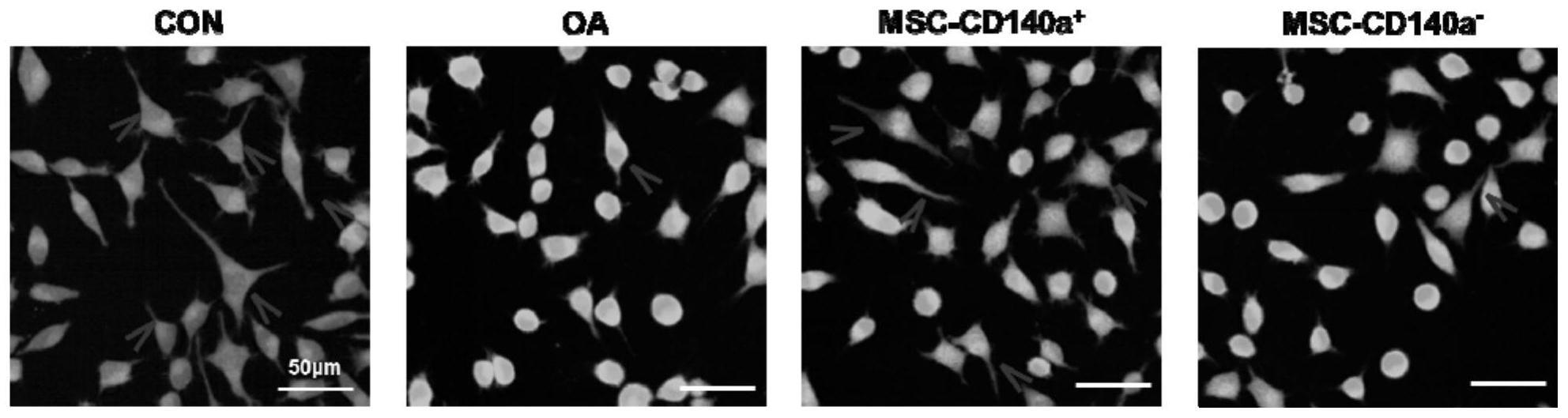 CD140a+间充质干细胞亚群在治疗神经损伤中的用途