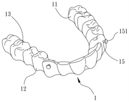 隐形牙套的矫正结构的制作方法