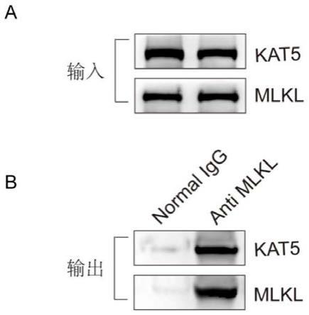 靶向抑制MLKL乙酰化的多肽和/或其衍生物及其用途