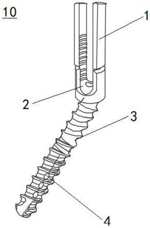 一种用于颈胸段脊柱的钉棒系统的制作方法