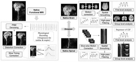 一种大脑与颈髓同步功能磁共振像的获取和数据处理方法