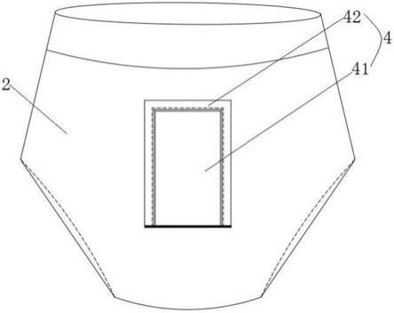 一种针对臀红及肛周疾病患儿改良版尿裤的制作方法
