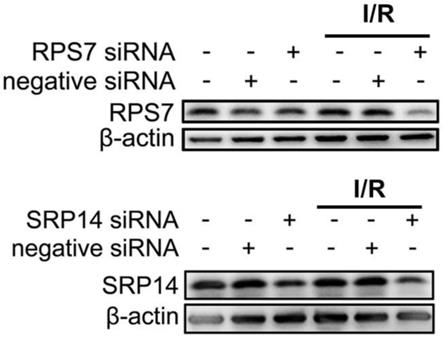 SRP14基因在治疗肾功能不全或肾损伤中的应用的制作方法