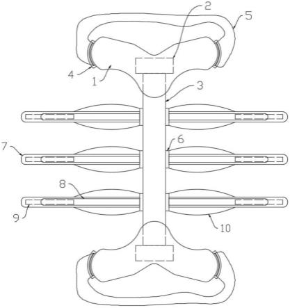 一种骨科脊柱侧弯矫正器的制作方法