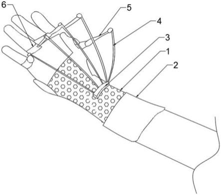 一种手伸肌腱可调式固定支具的制作方法