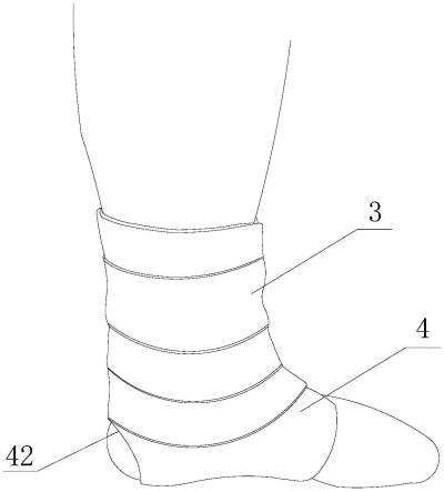 一种可调解剖型踝关节固定装置的制作方法