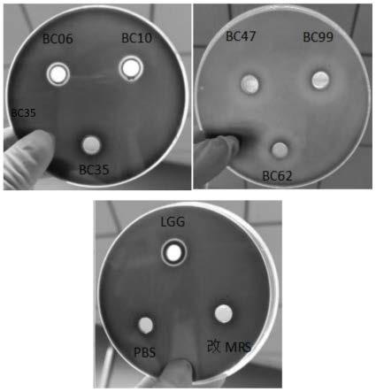 一种抗幽门螺杆菌的凝结芽孢杆菌BC99及其应用的制作方法
