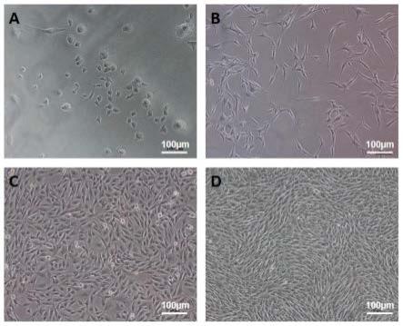 一种树鼩睾丸间质细胞的分离培养方法及其应用