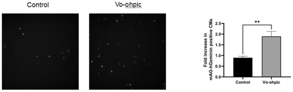 VO-OHPIC三水合物的药物新用途的制作方法