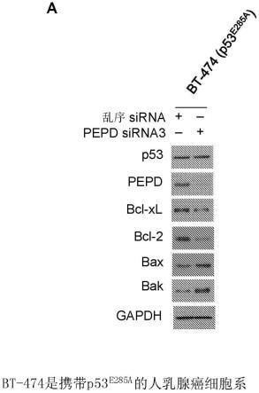 通过靶向氨酰基脯氨酸二肽酶(PEPD)重新激活P53突变体用于癌症治疗的制作方法