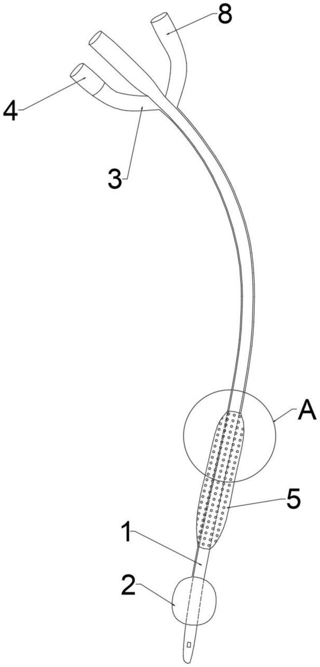 一种带有阴茎部尿道负压吸引套管的硅胶导尿管