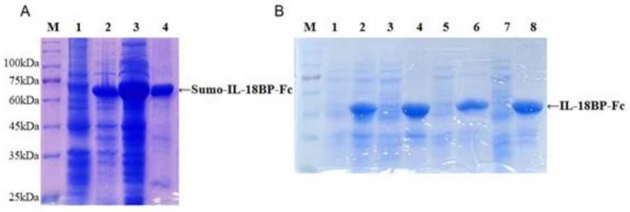 一种长效重组白细胞介素-18结合蛋白及其生产方法与应用