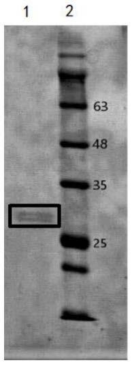 一种半滑舌鳎CHST12蛋白及其在抗菌中的应用的制作方法