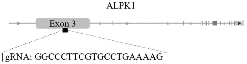 ALPK1基因在白内障诊断治疗及构建动物模型中的应用
