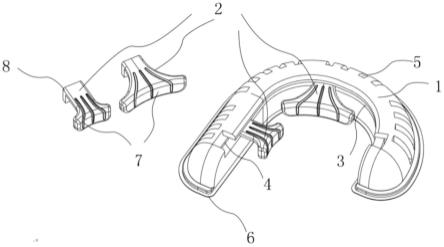 耳廓塑形器的制作方法