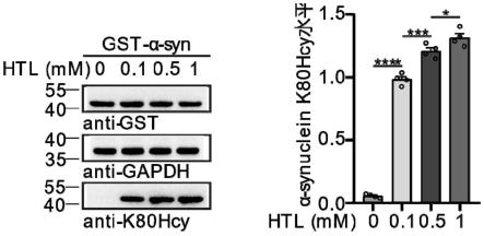 针对抗α-突触核蛋白K80Hcy抗体的抗原肽及其应用