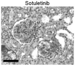 Sotuletinib在制备治疗新月体肾炎的药物中的应用