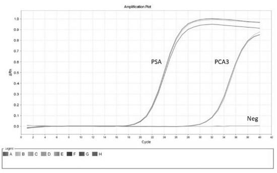 一种前列腺癌PCA3分数检测的试剂盒及方法与流程