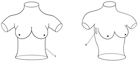 一种腔镜辅助下乳腺肿物切除术演示模具