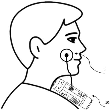 一种采用基于面部肌电信号的控制的电子人工喉的制作方法