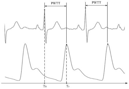 一种基于二阶三分算法自动分类的无创连续血压监测方法与流程