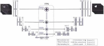 基于改进的FPN卷积神经网络脑肿瘤图像分割方法与流程