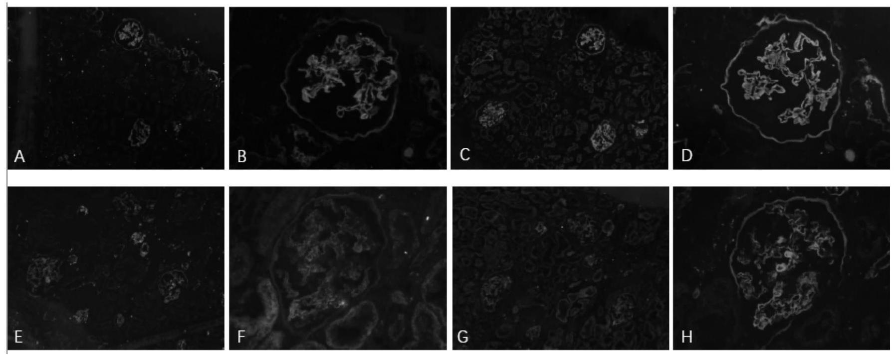 小鼠抗人IV型胶原α5链NC1段单克隆抗体及其应用