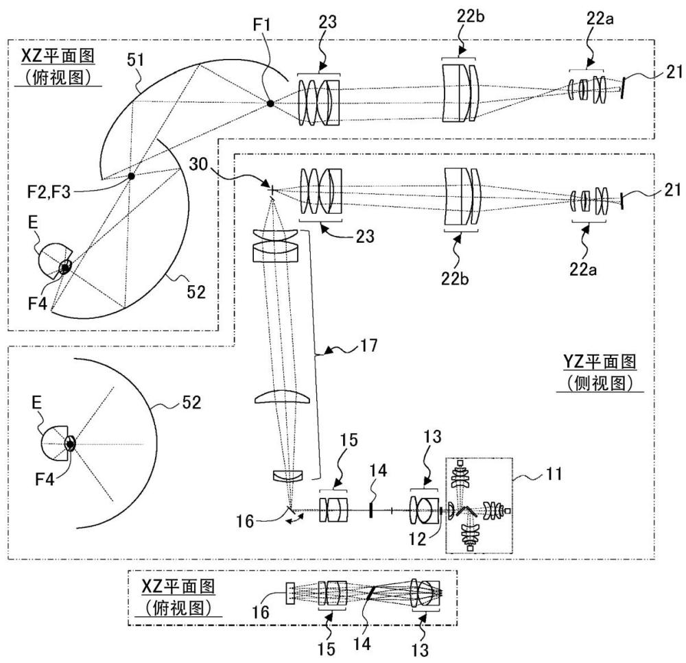 眼底拍摄装置的制作方法